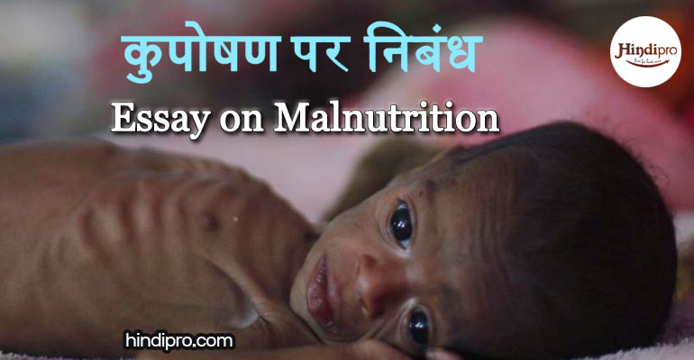कुपोषण पर निबंध Essay on Malnutrition in Hindi